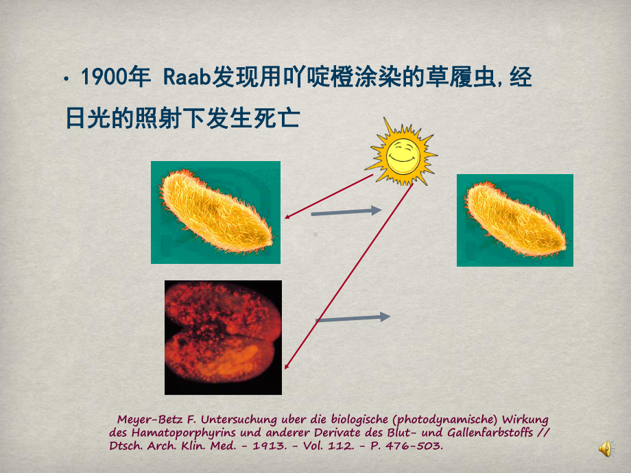 光动力疗法治疗眼表疾病课件.ppt_第2页