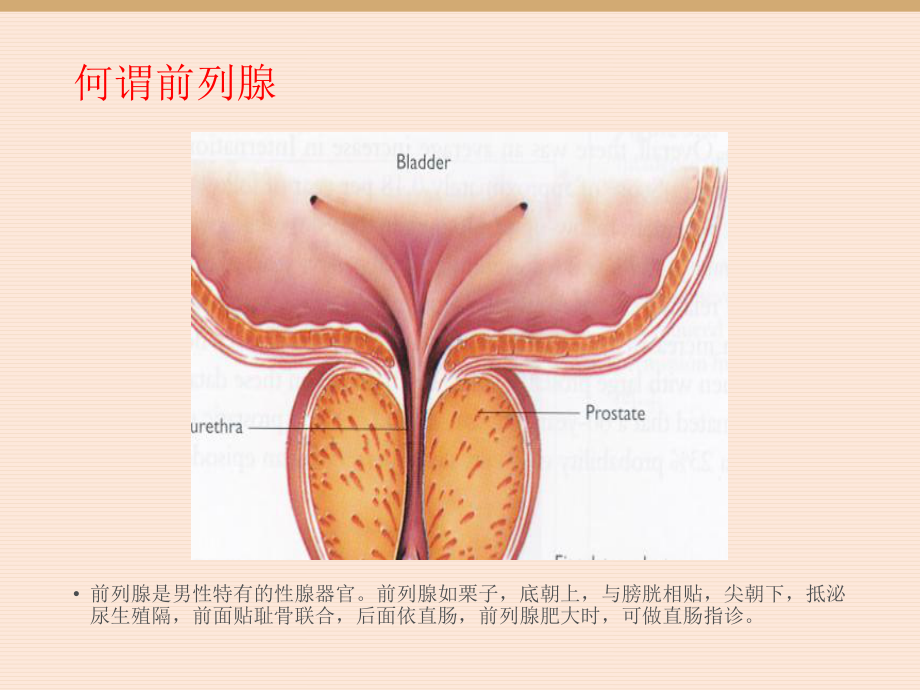 前列腺增生的围手术期护理(定稿)课件.ppt_第3页