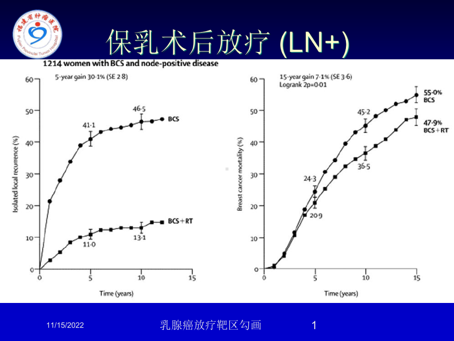 乳腺癌放疗靶区勾画课件.ppt_第1页