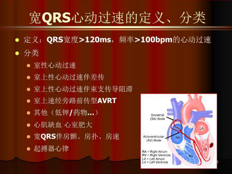 宽QRS心动过速的鉴别诊断-课件.ppt_第3页