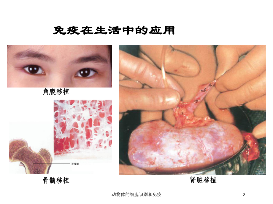 动物体的细胞识别和免疫培训课件.ppt_第2页