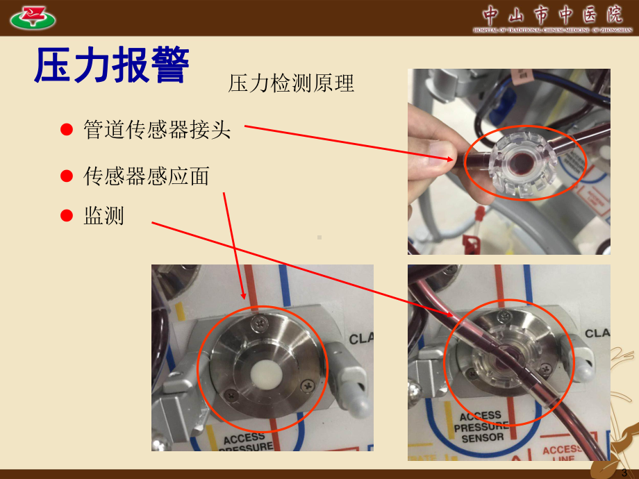 医学血液净化常见报警及处理培训课件.ppt_第3页