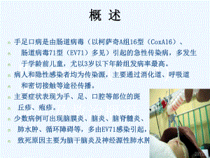 卫生部手足口病诊疗指南版课件.ppt