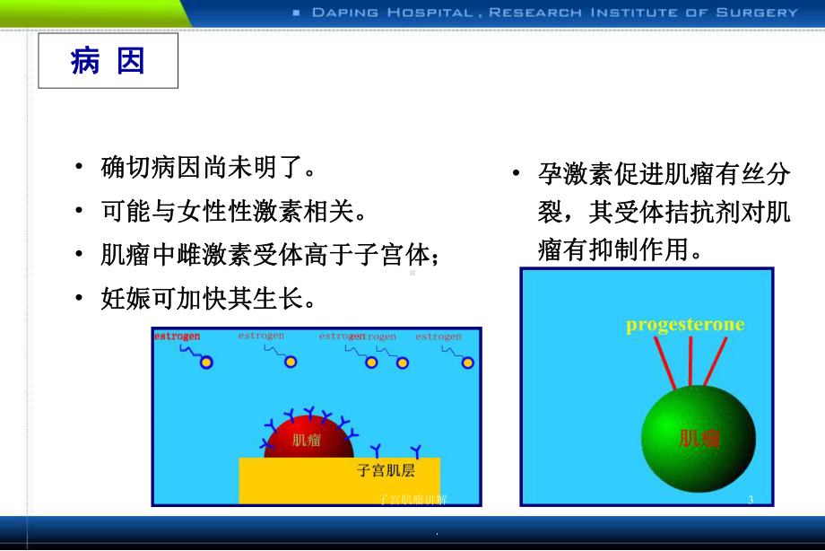 子宫肌瘤讲解培训课件.ppt_第3页