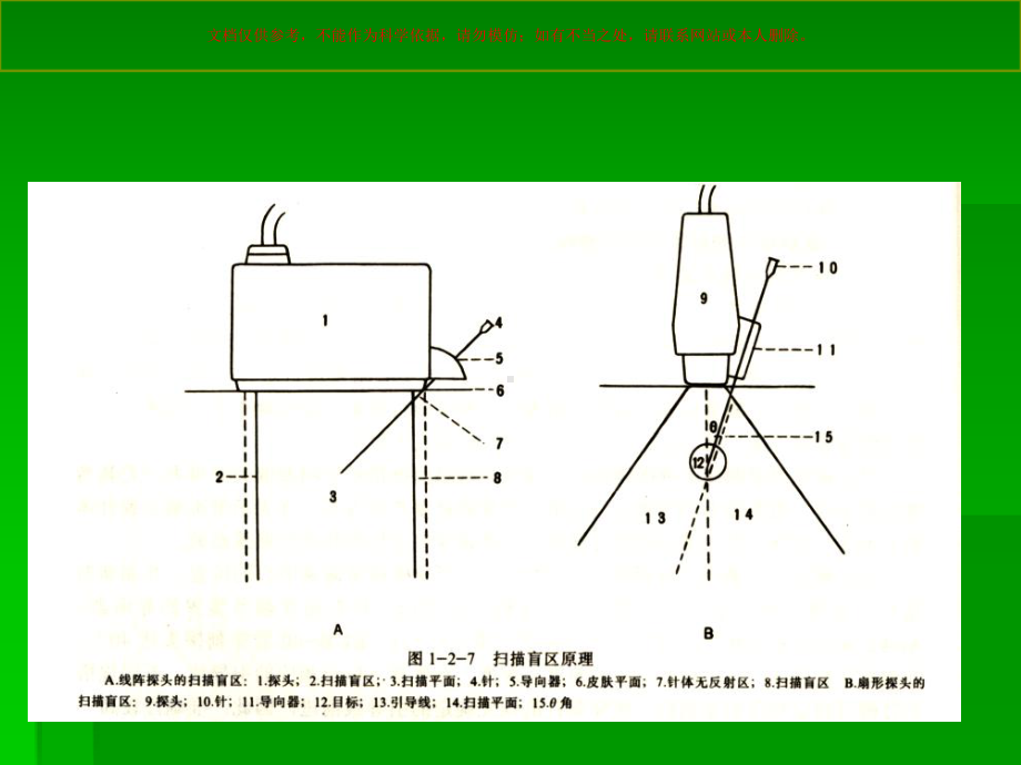 介入性超声医学知识专题讲座培训课件.ppt_第2页