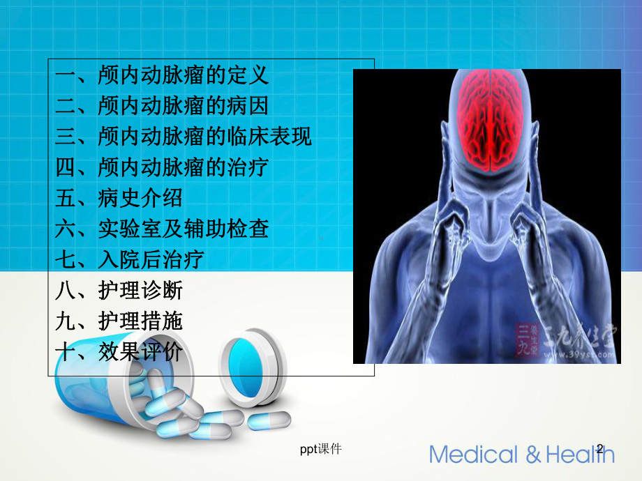 动脉瘤护理查房-课件.ppt_第2页