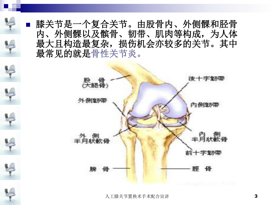 人工膝关节置换术手术配合宣讲培训课件.ppt_第3页