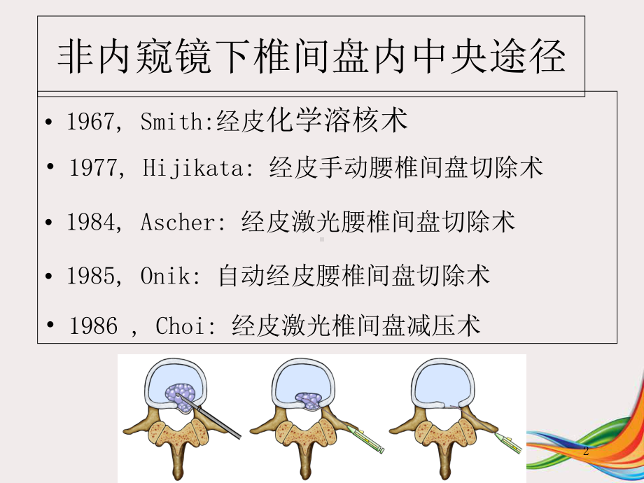 医学课件-不同脊柱微创技术简介课件.ppt_第2页