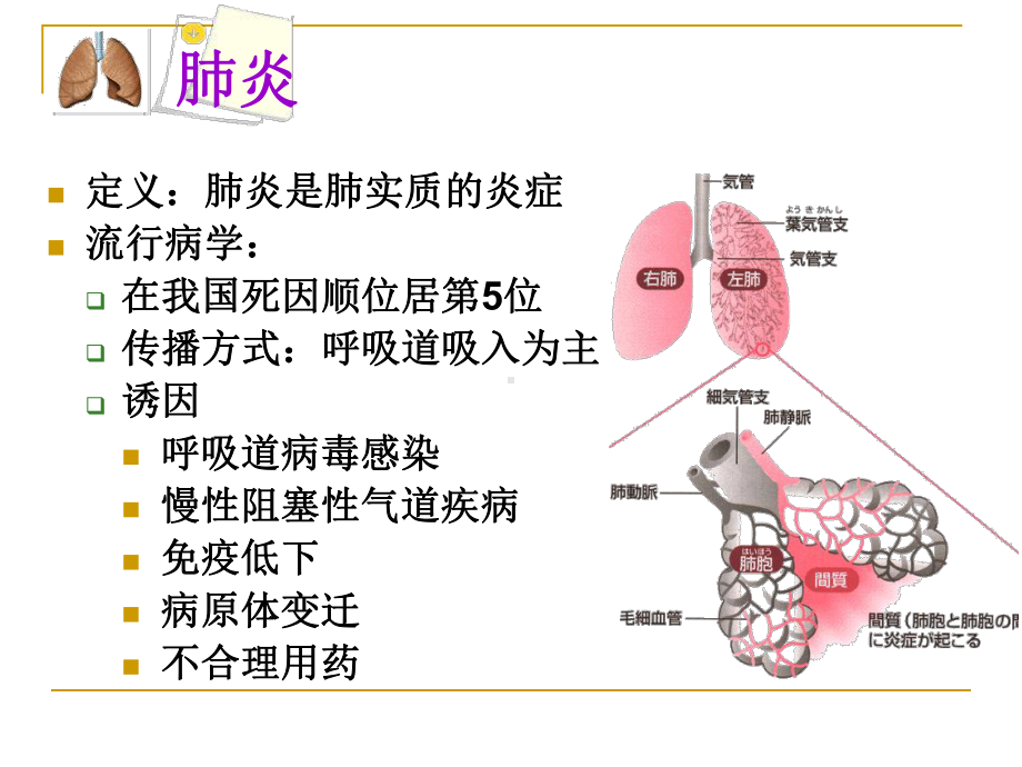 内科护理学-呼吸系统-肺炎课件.ppt_第2页