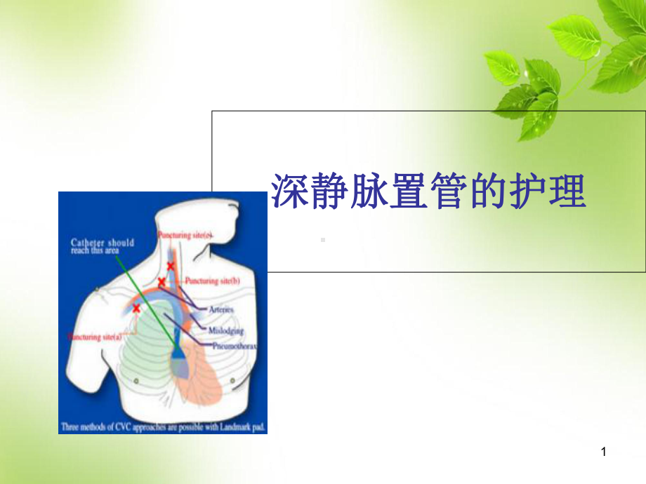 医学课件-深静脉置管的护理课件.ppt_第1页