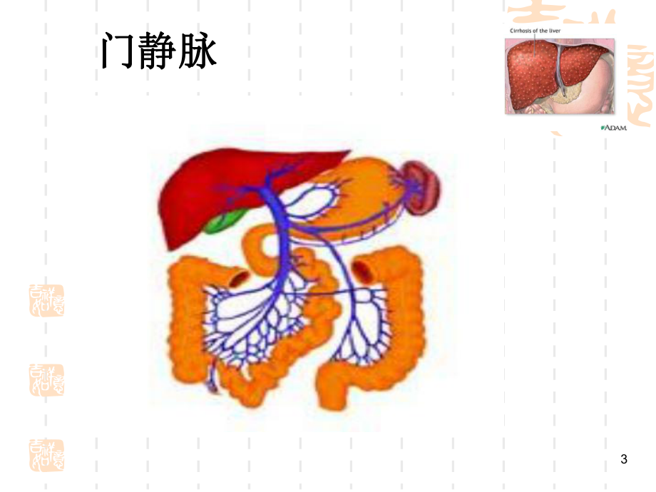 内科护理学肝硬化病人的护理课件.ppt_第3页