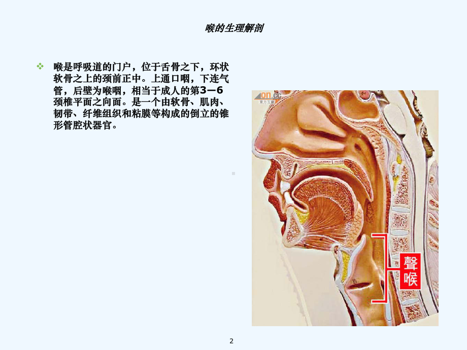 喉癌与其护理课件.ppt_第2页