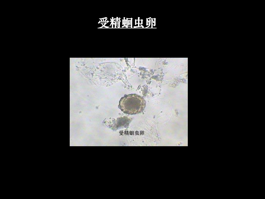 人体寄生虫标本培训课件.ppt_第2页