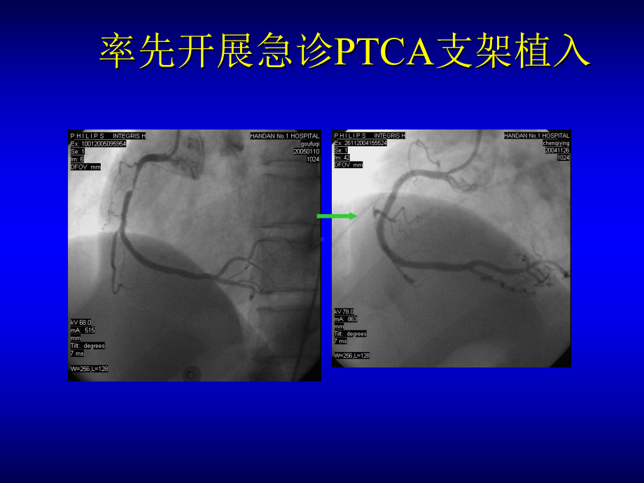 医学课件-冠心病的正确诊断及治疗新策略教学课件.ppt_第3页