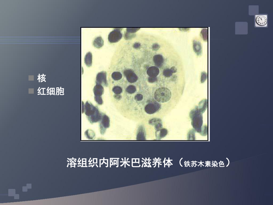 寄生虫实验考图片解说课件.ppt_第3页