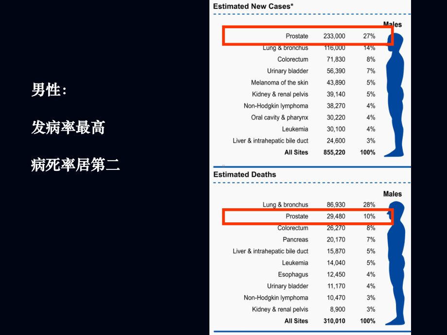 前列腺癌课件.pptx_第2页