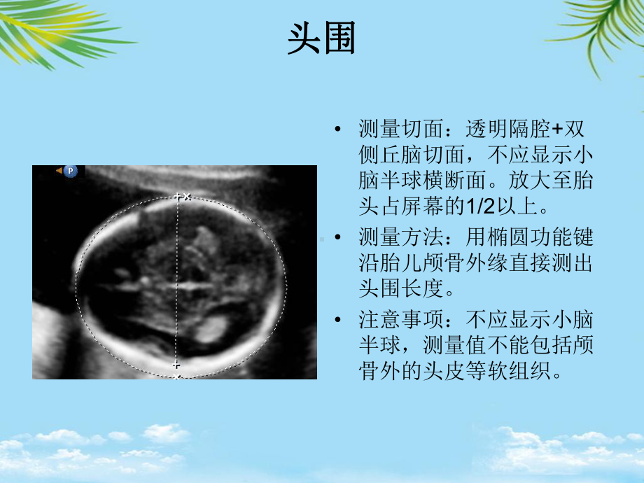 产科超声标准切面张图全面版课件.ppt_第1页