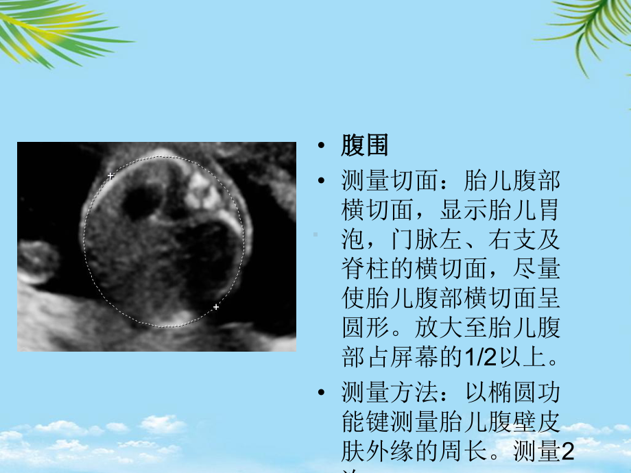 产科超声标准切面张图全面版课件.ppt_第2页