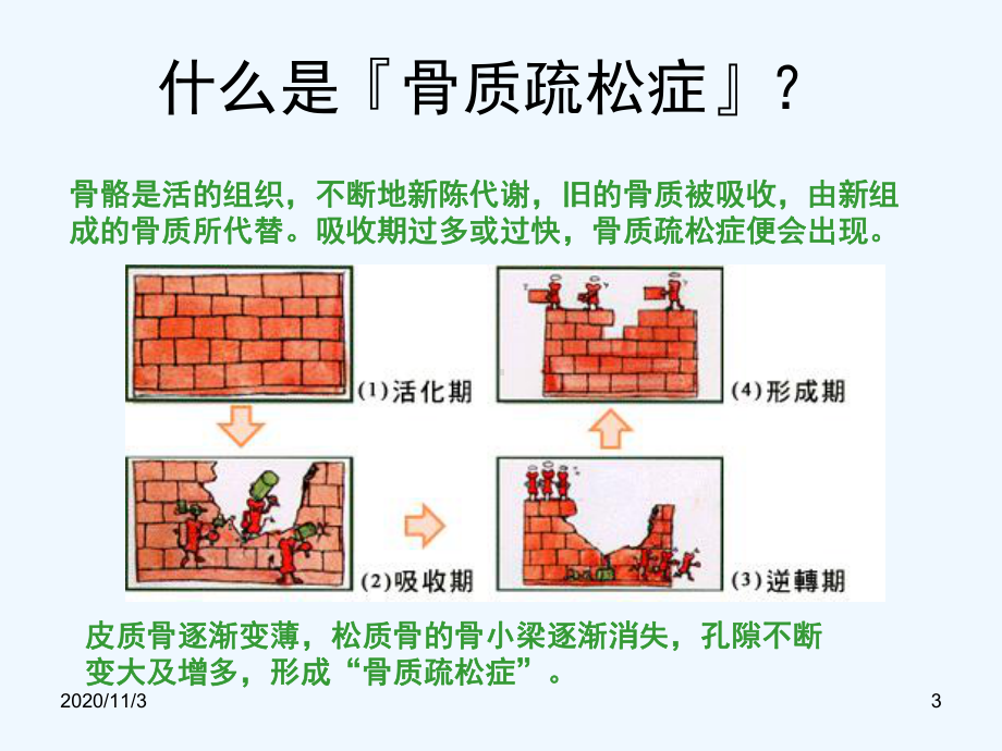 关节痛之骨质疏松课件.ppt_第3页