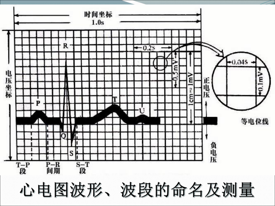 修改版异常心电图图谱汇总课件.ppt_第3页