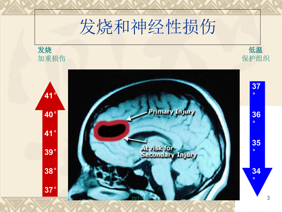 亚低温治疗-课件.ppt_第3页