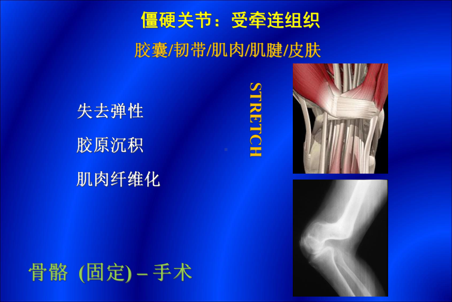 关节康复治疗方法课件.ppt_第3页