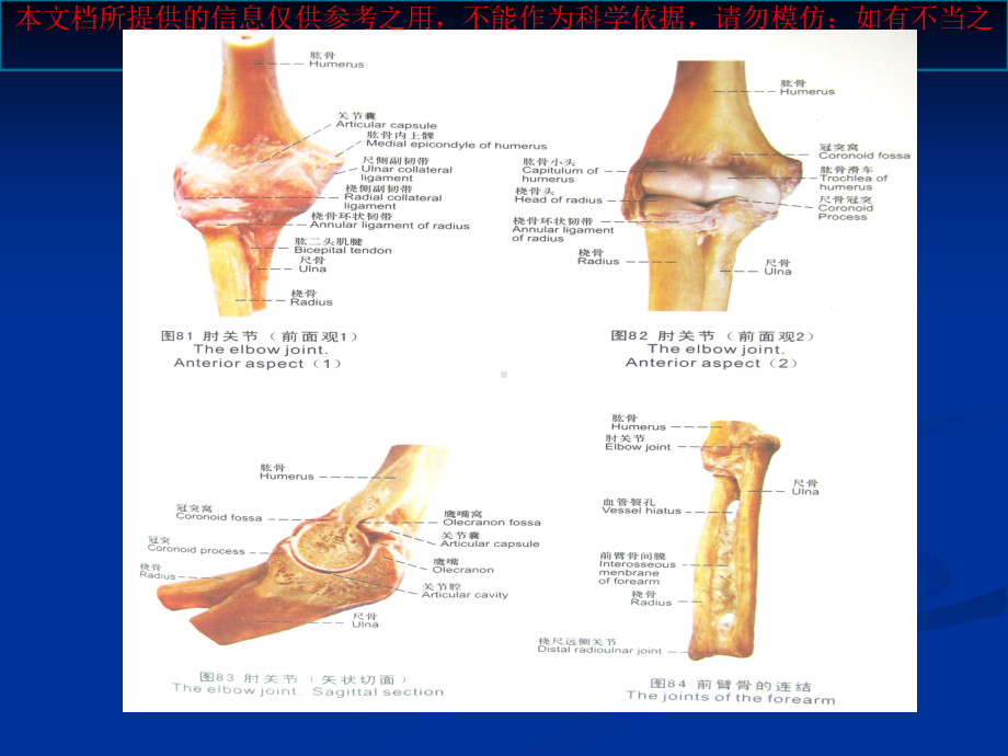 小儿肱骨髁上骨折培训课件.ppt_第2页