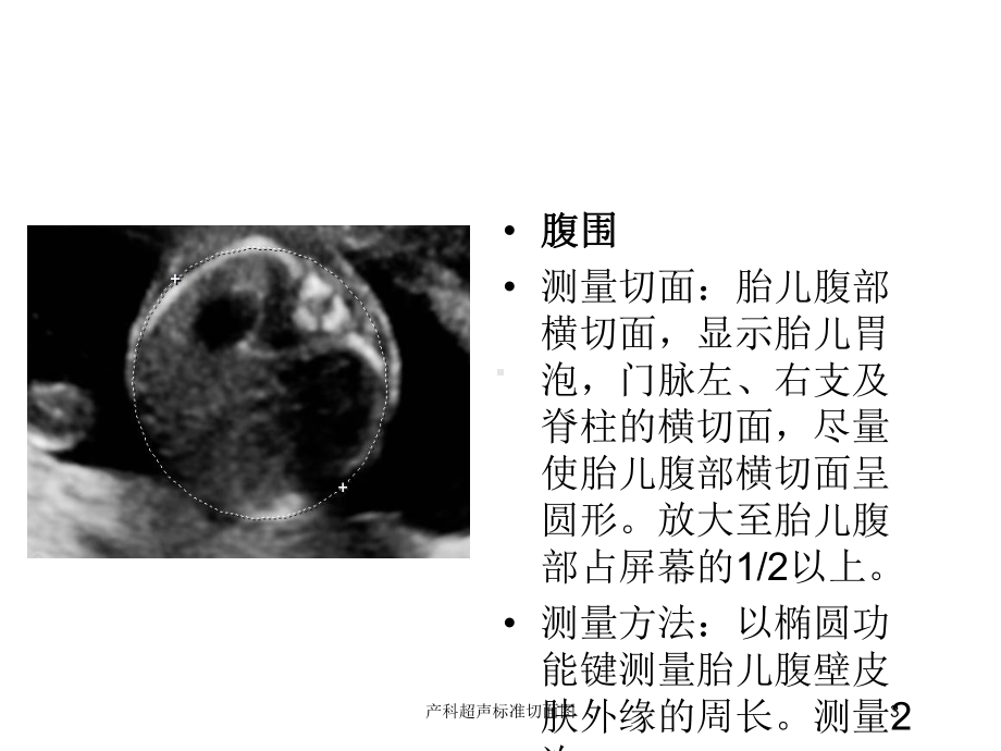 产科超声标准切面图培训课件.ppt_第3页