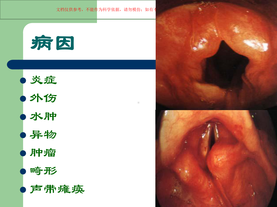 喉阻塞医学知识专题宣讲培训课件.ppt_第2页