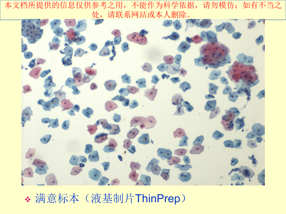 宫颈液基细胞学诊疗培训课件.ppt_第3页