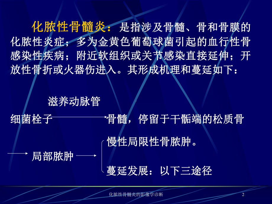 化脓性骨髓炎的影像学诊断培训课件.ppt_第2页