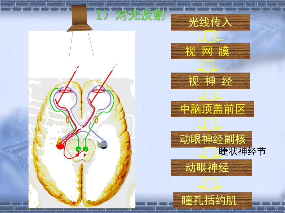 医学课件神经系统定位诊断材料.ppt_第2页