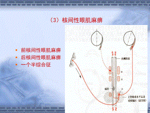 医学课件神经系统定位诊断材料.ppt