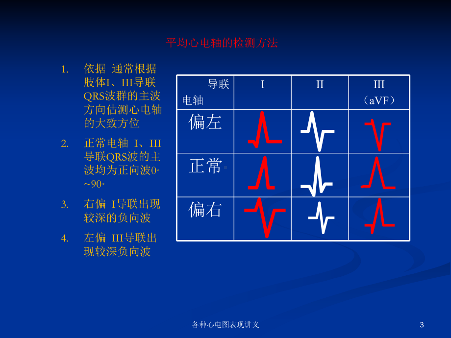 各种心电图表现讲义培训课件.ppt_第3页