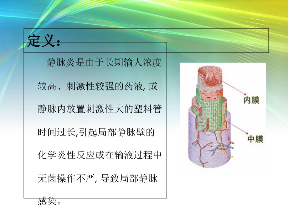 化疗性静脉炎的护理教材课件.ppt_第3页