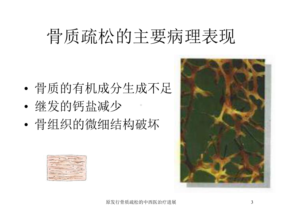 原发行骨质疏松的中西医治疗进展培训课件.ppt_第3页