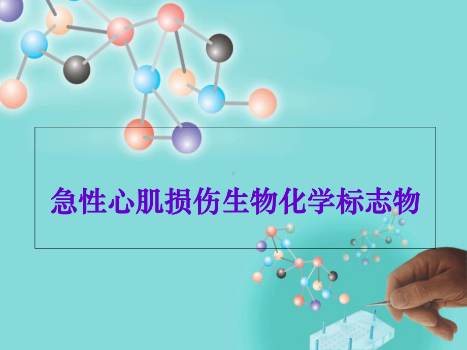 医学课件-急性心肌损伤生物化学标志物教学课件.ppt_第2页