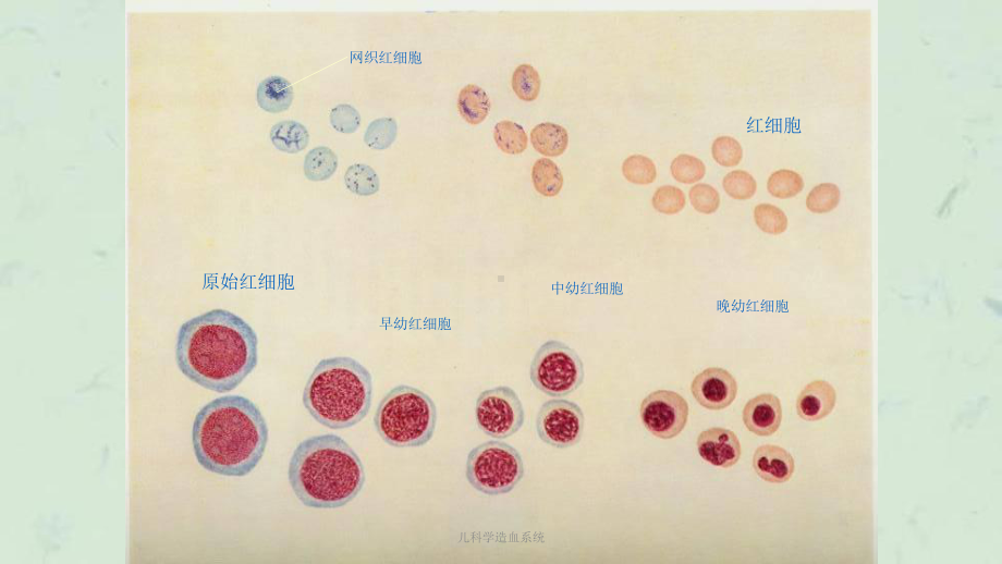 儿科学造血系统课件.ppt_第3页