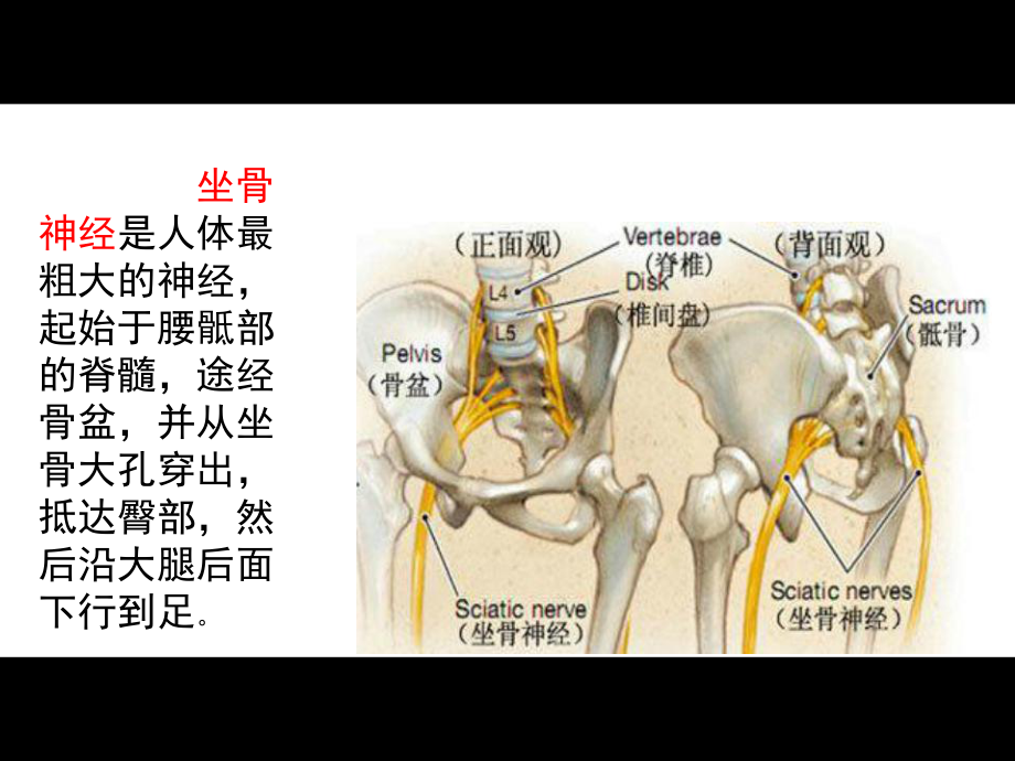 医学课件梨状肌综合征的影像诊疗.ppt_第3页