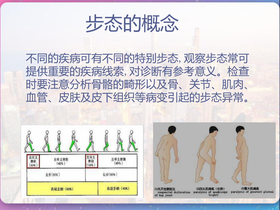 姿势步态及其意义-诊断学-骨科外科学-课件.pptx_第3页