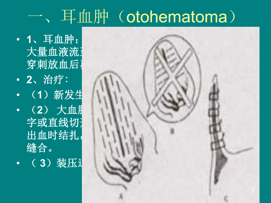 医学课件-各部外科病教学课件.ppt_第2页