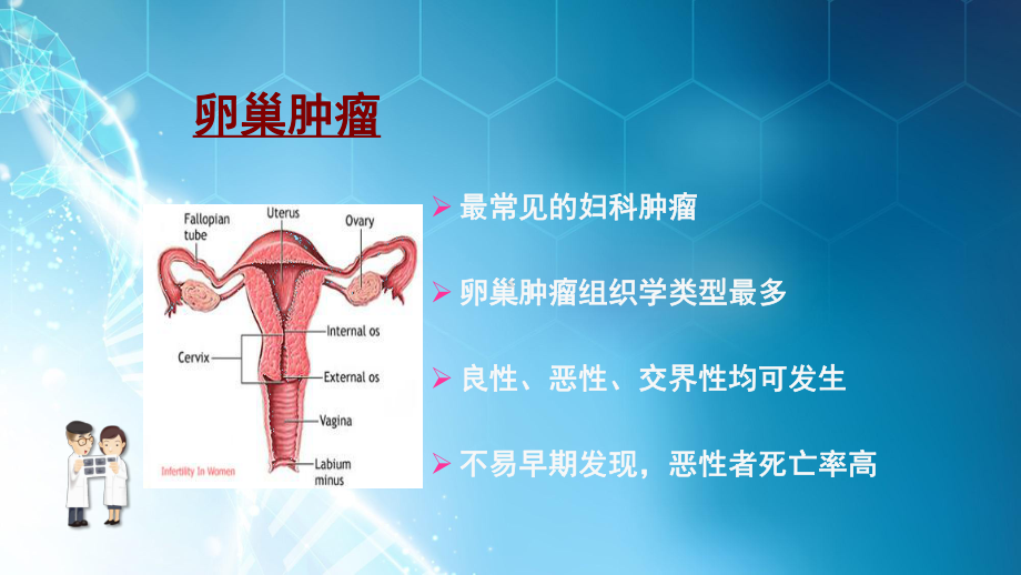 卵巢肿瘤概论课件.pptx_第2页