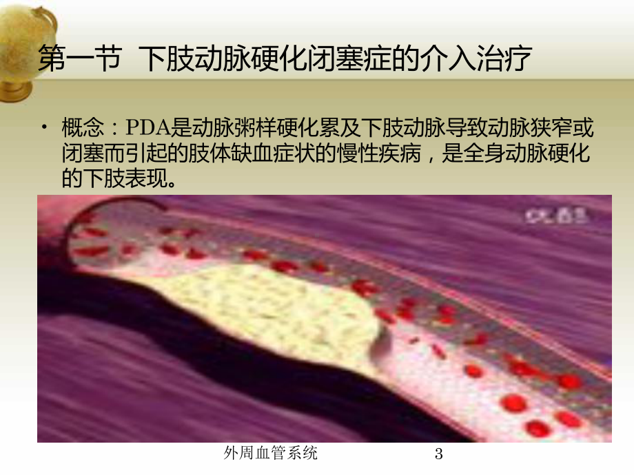 外周血管系统培训课件.ppt_第3页