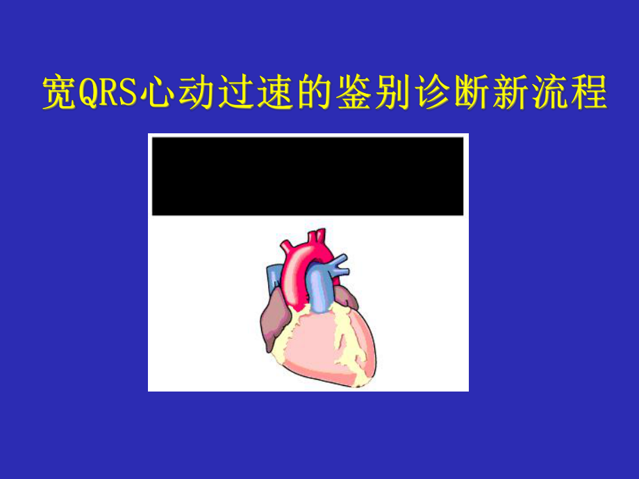 宽QRS波心动过速鉴别诊断课件-2.ppt_第1页