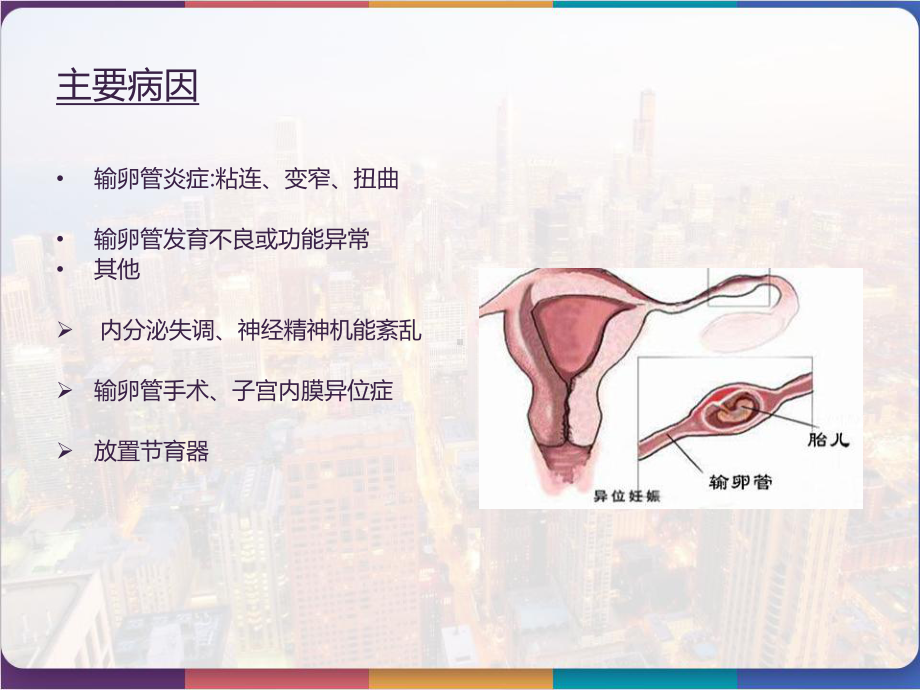 宫外孕腹腔镜术前术后的护理-课件.pptx_第3页