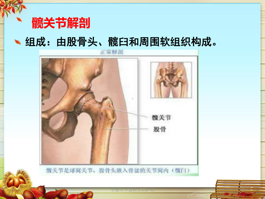 全髋关节置换术后护理培训课件.ppt_第2页