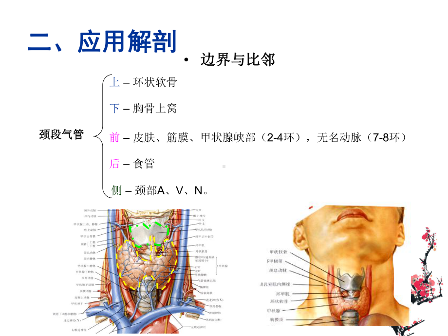 医学课件气管切开术医疗研究.ppt_第3页