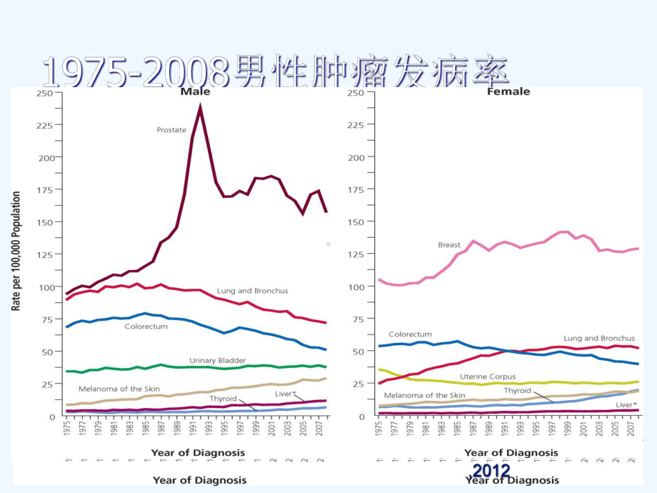 前列腺癌诊治进展课件.ppt_第3页