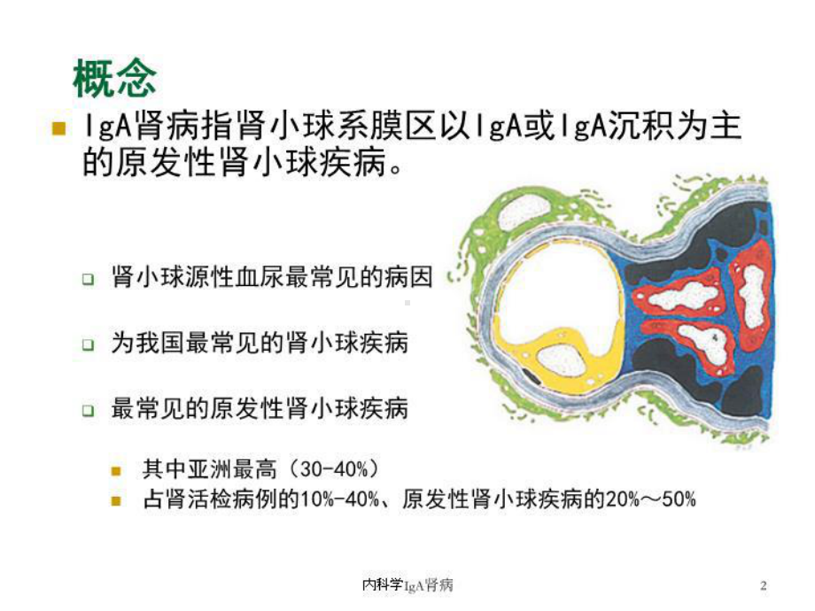 内科学IgA肾病培训课件.ppt_第2页