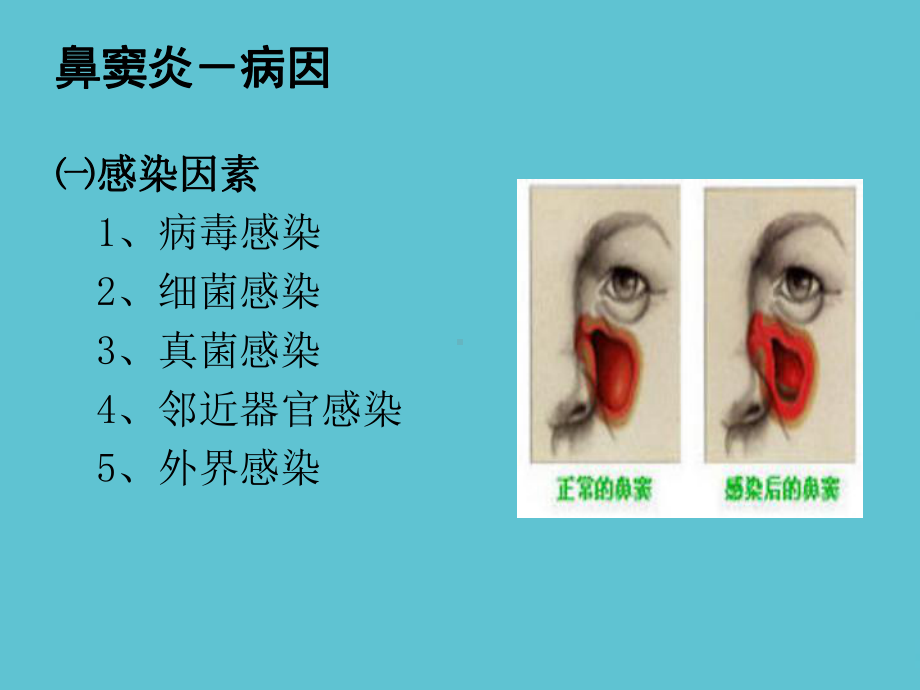 五官科常见病例及诊治课件.ppt_第2页